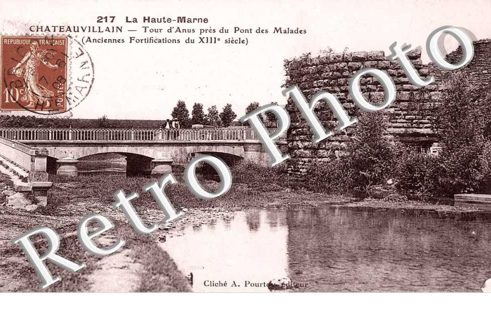 Tour d'Anus pres du pont des malades