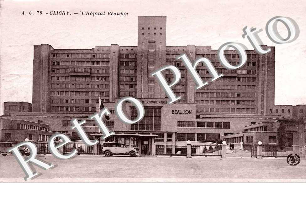 Hopital Beaujon