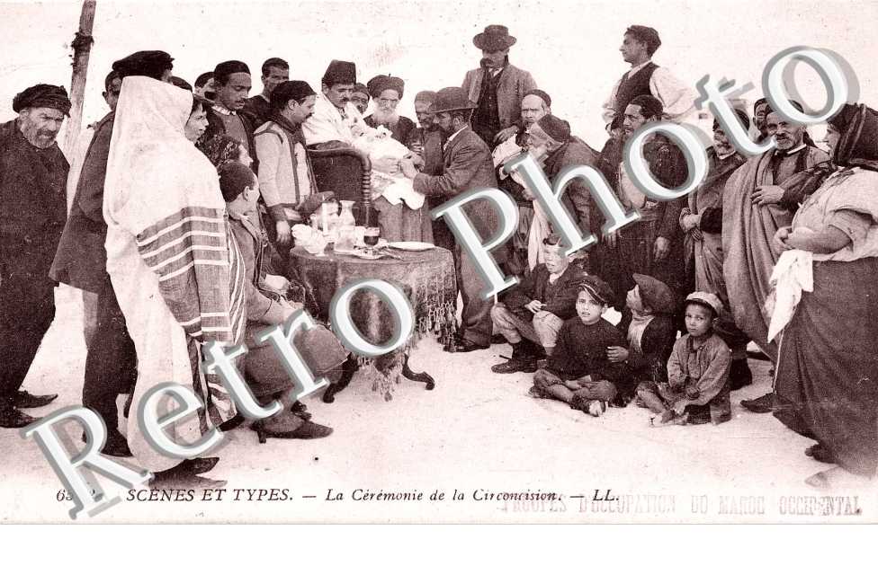 la ceremonie de la circoncision