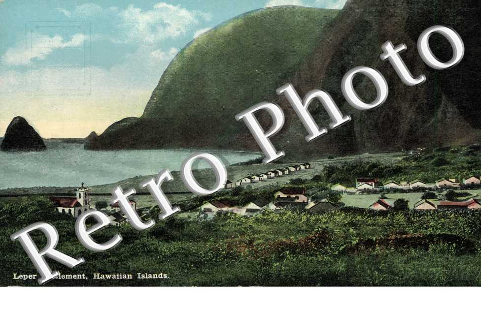 Lepper settlement