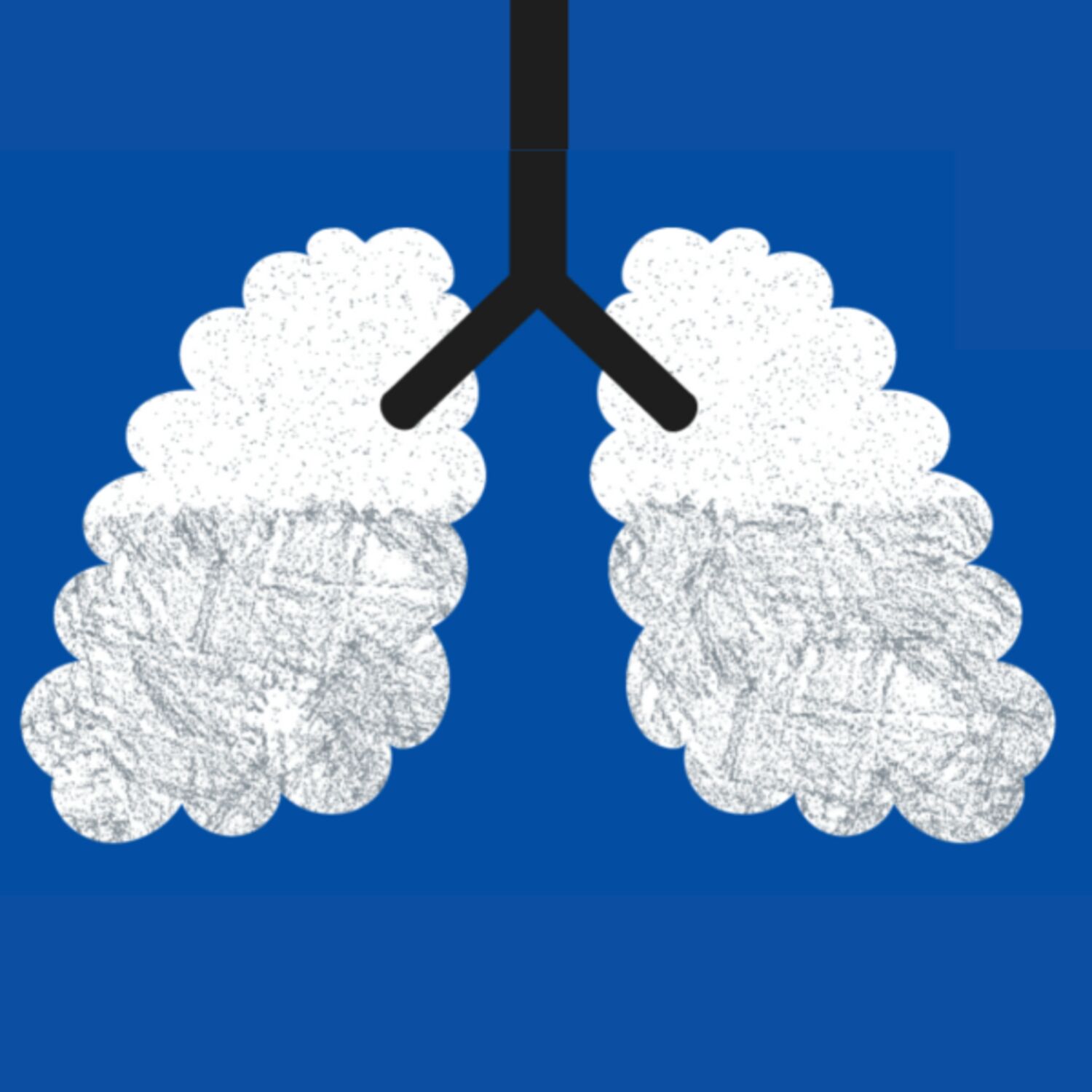 Lepší vzduch, menej hluku: ako chce k tomu prispieť Európska únia?