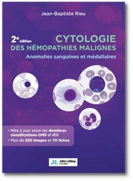 Livres Santé et Médecine Médecine Spécialités Cytologie des hémopathies malignes, Anomalies sanguines et médullaires Jean-Baptiste Rieu