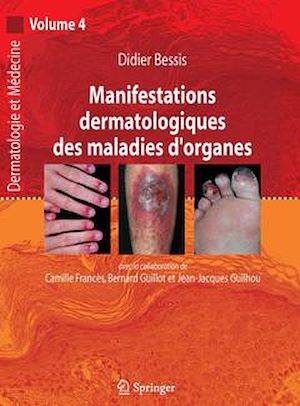 Manifestations dermatologiques des maladies d'organes (Dermatologie et médecine, volume 4), (Dermatologie et médecine, Vol. 4)