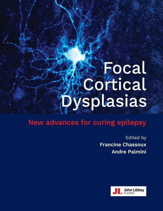 Livres Santé et Médecine Médecine Spécialités Focal Cortical Dysplasias, New advances for curing epilepsy Francine Chassoux, Andre Palmini