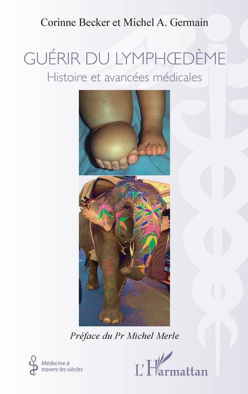 Livres Santé et Médecine Médecine Généralités Guérir du lymphoedème, Histoires et avancées médicales Michel Germain