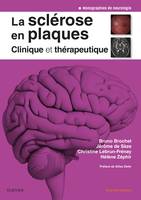 La sclérose en plaques - Clinique et thérapeutique