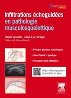 Infiltrations échoguidées, en pathologie musculosquelettique