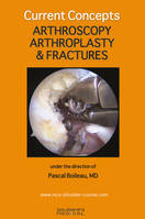 Arthroscopy, arthroplasty & fractures, COLL NICE SHOULDER