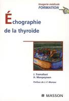 Échographie de la thyroïde