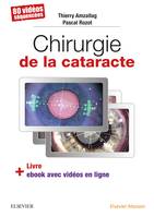 Chirurgie de la cataracte, 60 Videos Sequencees