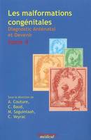 4, Les malformations congénitales diagnostic anténatal et devenir