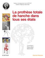 La prothèse totale de hanche dans tous ses états, Dans Tous Ses Etats