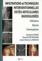 INFILTRATIONS ET TECHNIQUES INTERVENTIONNELLES OSTEO-ARTICULAIRES RADIOGUIDEES, infiltrations, biopsies, cimentoplasties