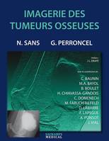 Imagerie des tumeurs osseuses