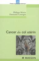 Cancer du col utérin