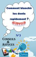 Comment blanchir les dents rapidement ? (Conseils et astuces), Conseils et Astuces