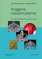 Imagerie nasosinusienne, Du plus fréquent au plus rare