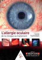 L'allergie oculaire, De la clinique au traitement