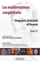 11, Les malformations congénitales, Diagnostic anténatal et devenir