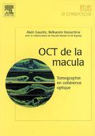 OCT DE LA MACULA - TOMOGRAPHIE EN COHERENCE OPTIQUE DANS LES MALADIES DE LA MACULA, tomographie en cohérence optique