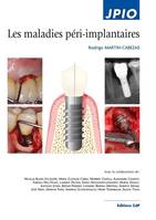 Les maladies péri-implantaires