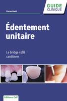 Edentement unitaire - Le bridge collé cantilever