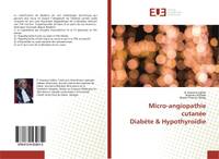 Micro-angiopathie cutanEeDiabEte & HypothyroIdie