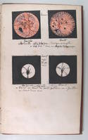 Leçons sur l'exploration de l'oeil et en particulier sur les applications de l'ophtalmoscope au diagnostic des maladies des yeux