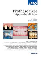 Prothèse fixée, 2e Ed., Approche clinique