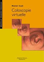 Coloscopie virtuelle