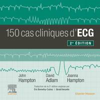 150 cas cliniques d'ECG