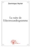 La suite de l'électrocardiogramme