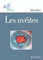 Les uvéites, Rapport SFO 2010