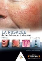 La rosacée, De la clinique au traitement