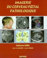 Imagerie du cerveau foetal pathologique