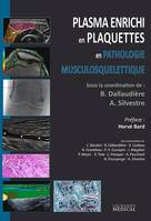 PLASMA ENRICHI EN PLAQUETTES EN PATHOLOGIE MUSCULOSQUELETTIQUE