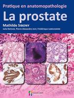 PRATIQUE EN ANATOMOPATHOLOGIE - LA PROSTATE