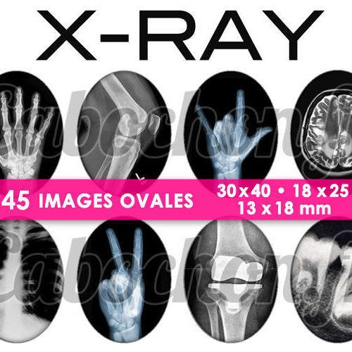 X-ray ☆ 45 images digitales numériques ovales 30x40 18x25 et 13x18 mm page cabochons 