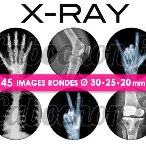 X-ray ☆ 45 images digitales numériques rondes 30 25 et 20 mm page de collage digital pour cabochons 
