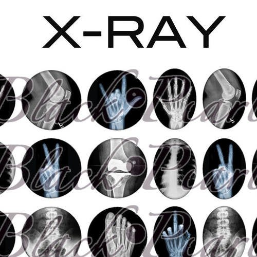 ° x-ray ° - page digitale pour cabochons - 60 images  à imprimer 