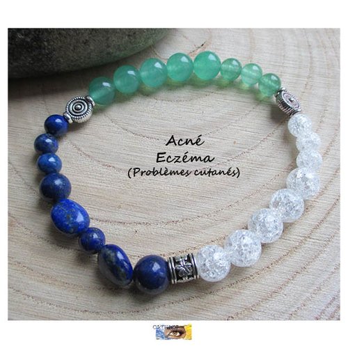 Bracelet "acné-eczéma" - lapis lazuli, aventurine, cristal de roche craquelé, bracelet pierre naturelle, litho