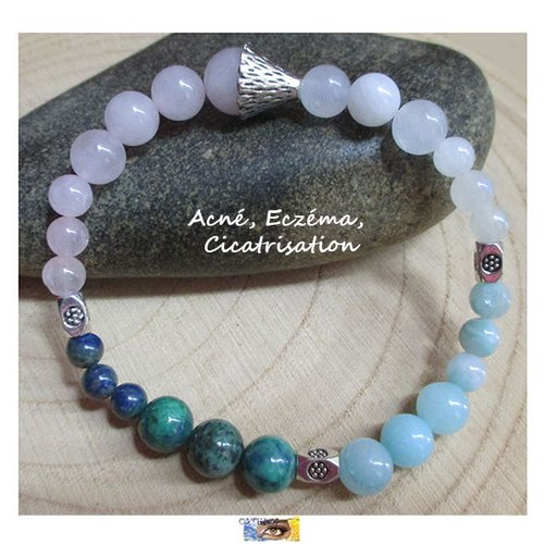 Bracelet "acné-eczéma-cicatrisation" - quartz rose, azurite malachite, amazonite, pierre de lune, bracelet pierre naturelle, perles, litho