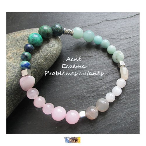 Bracelet "acné-eczéma-cicatrisation" - quartz rose, azurite malachite, amazonite, pierre de lune, bracelet pierre naturelle, perles, litho