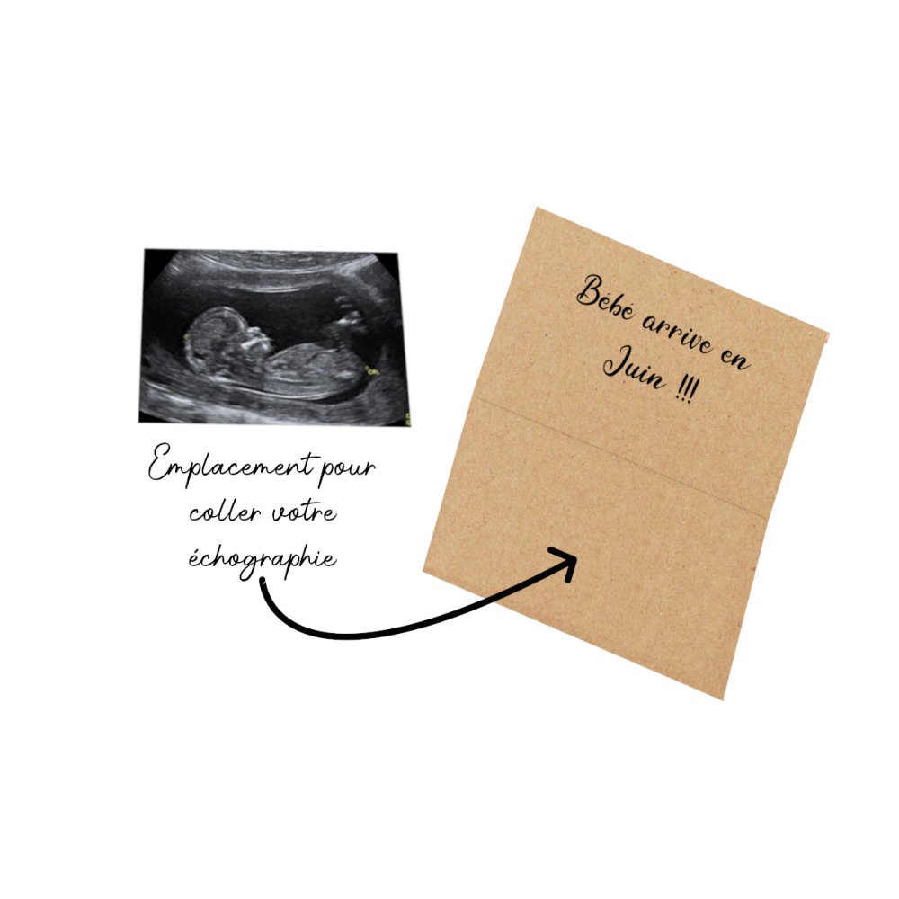 Carte annonce de grossesse personnalisée avec VOTRE échographie -  Lachouettemauve
